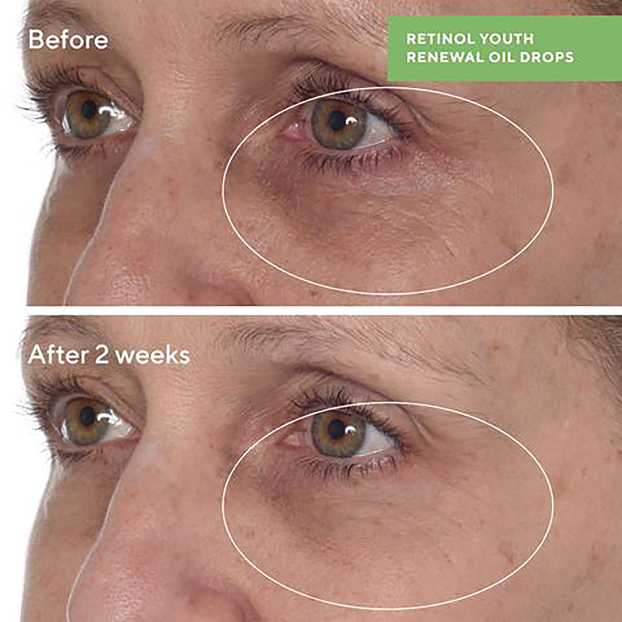 Murad Retinol Youth Renewal Oil Drops 30 ml (obrázok 6)