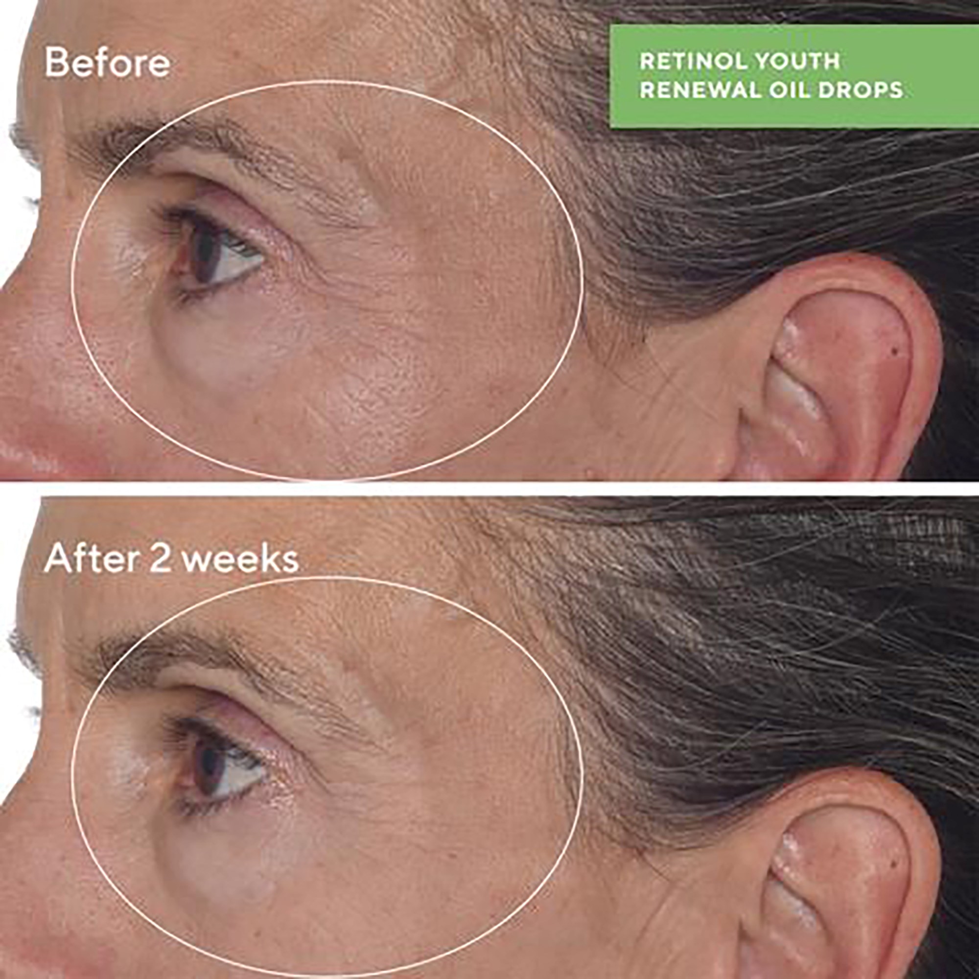 Murad Retinol Youth Renewal Oil Drops 30 ml (obrázok 7)