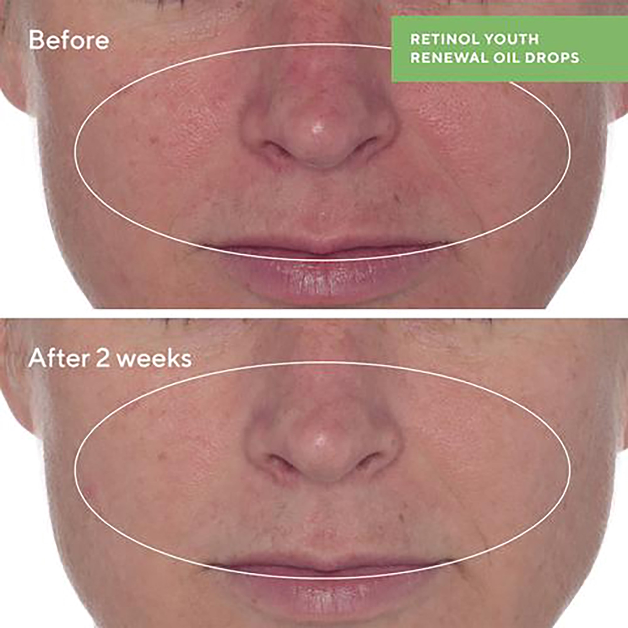 Murad Retinol Youth Renewal Oil Drops 30 ml (obrázok 8)