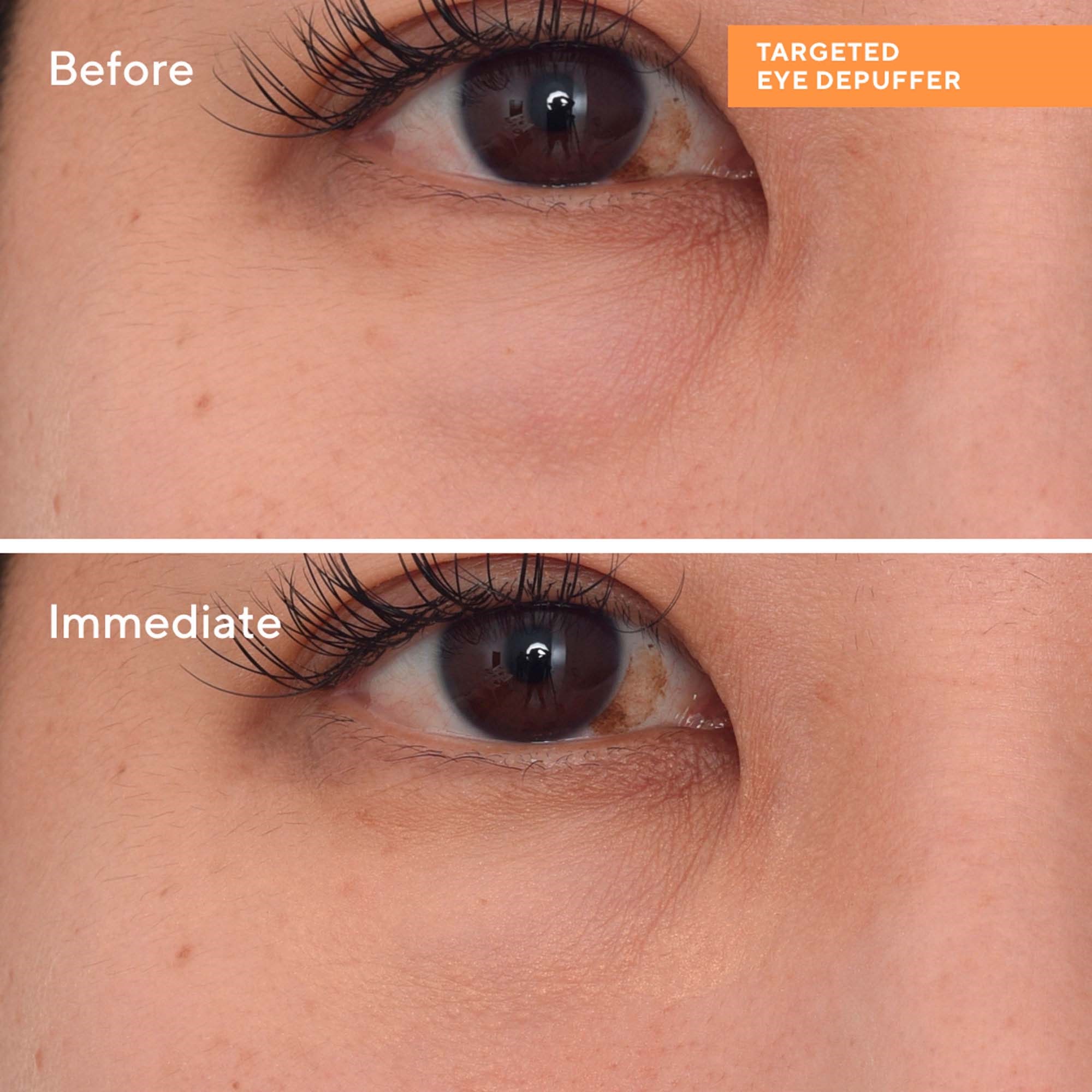 Murad Targeted Eye Depuffer 15 ml (obrázok 7)
