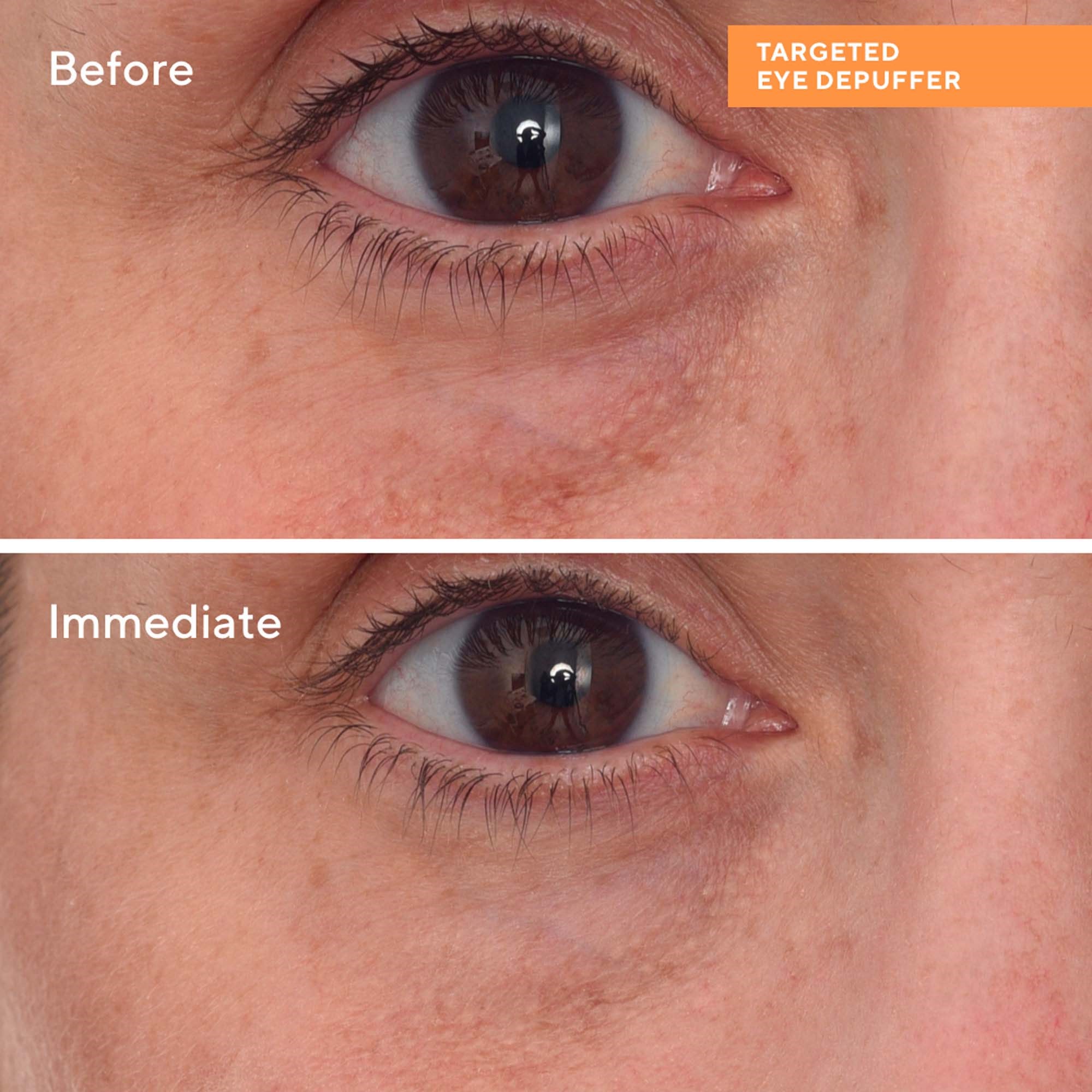 Murad Targeted Eye Depuffer 15 ml (obrázok 8)