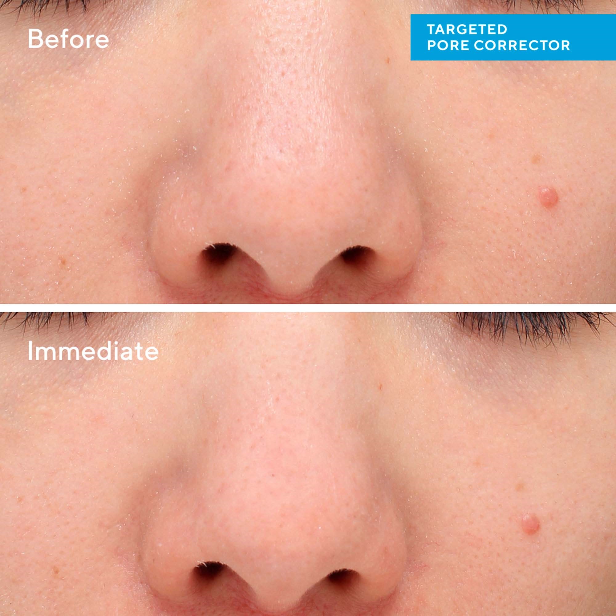 Murad Targeted Pore Corrector 15 ml (obrázok 6)