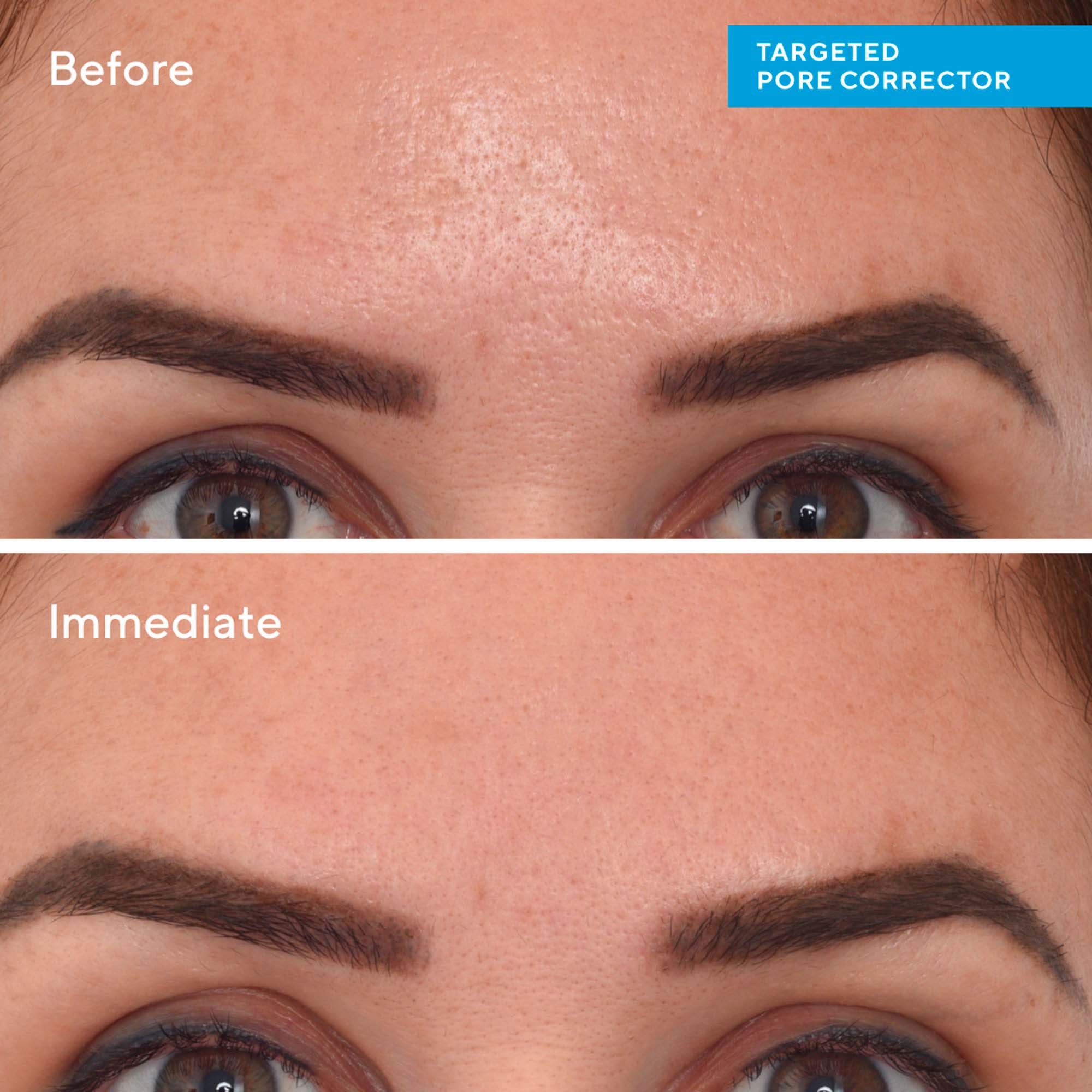 Murad Targeted Pore Corrector 15 ml (obrázok 7)
