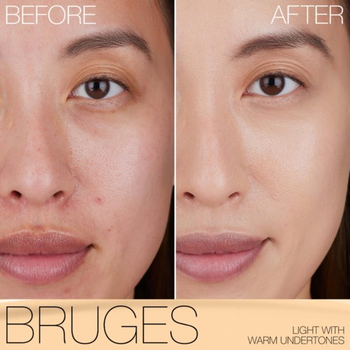 Before and after images of a person showing clearer, smoother skin, less acne, and improved complexion.