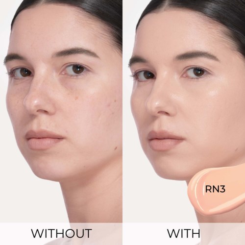 Före- och efterbilder av hud som visar mindre acne och sämjor, med jämnare och klarare hud efter behandling.