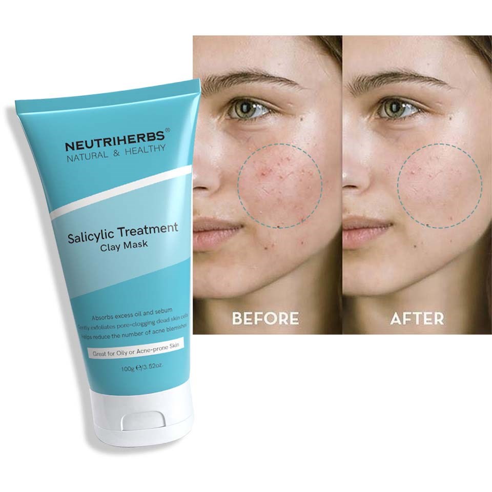 Neutriherbs Salicylic Acid Clay Mask 100 g (obrázok 8)