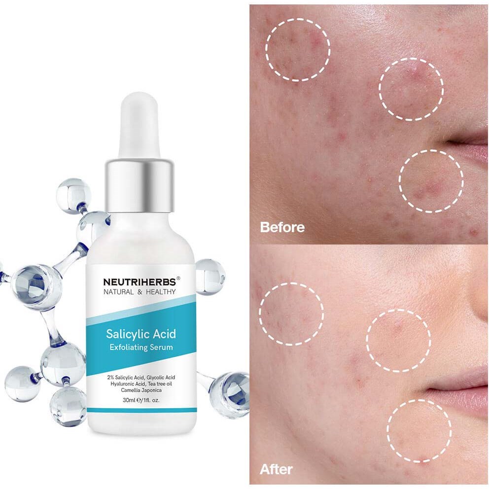 Neutriherbs Salicylic Acid Serum 30 ml (obrázok 10)