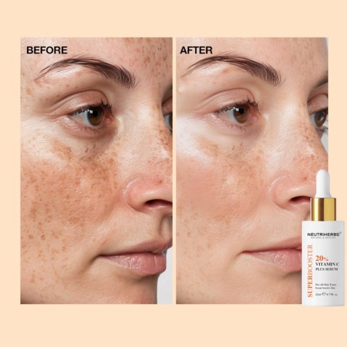 Сыворотка для лица Neutriherbs Vitamin C Plus 20% Brightening Serum, осветляющая, антиоксидантная, 30 мл — фото 3