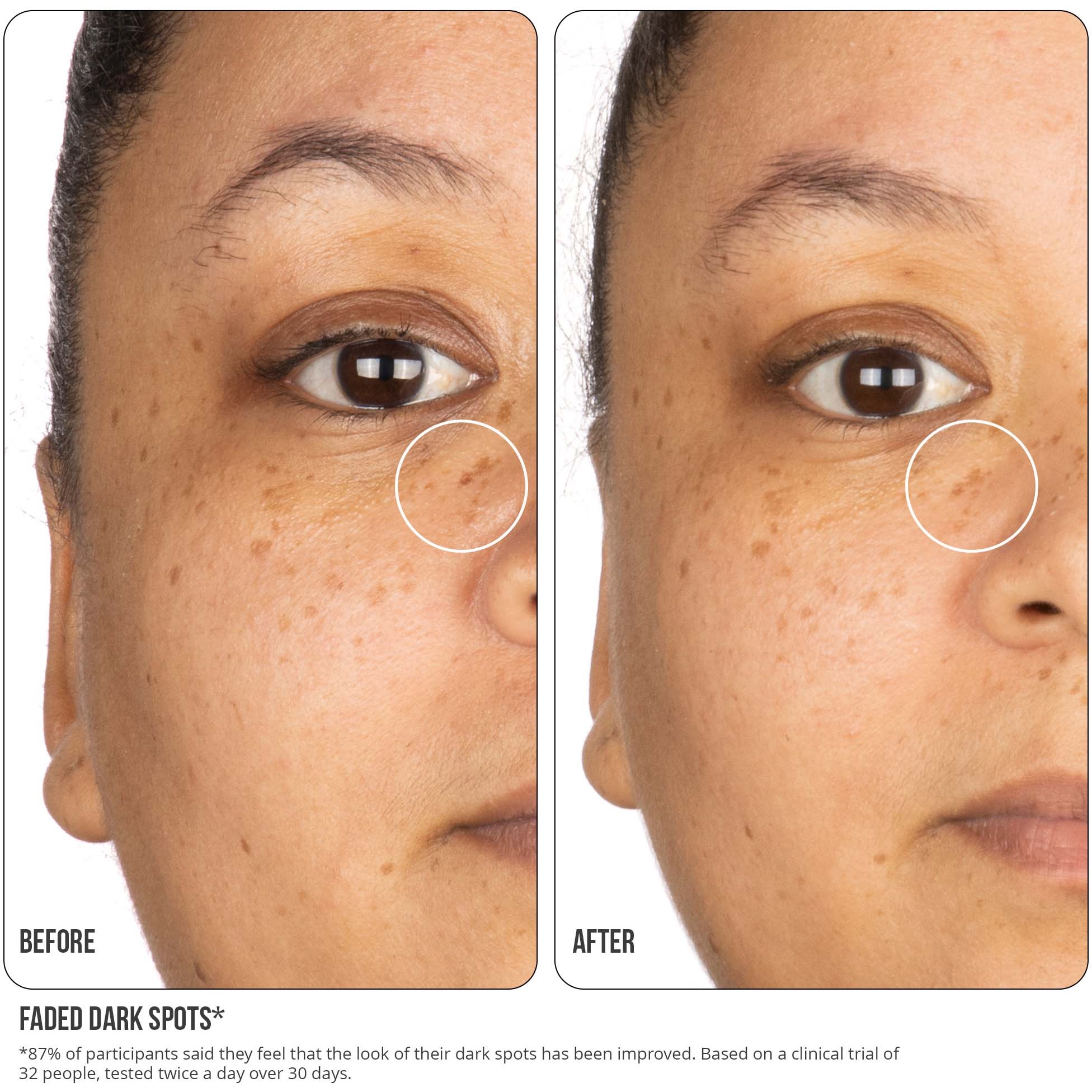 Alternativ bild 1 för NIP+FAB Vitamin C Fix Concentrate Extreme 15% 30 ml