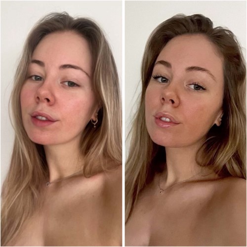 Twee foto's van een jonge vrouw, haar gezicht voor en na make-up of huidverzorging.