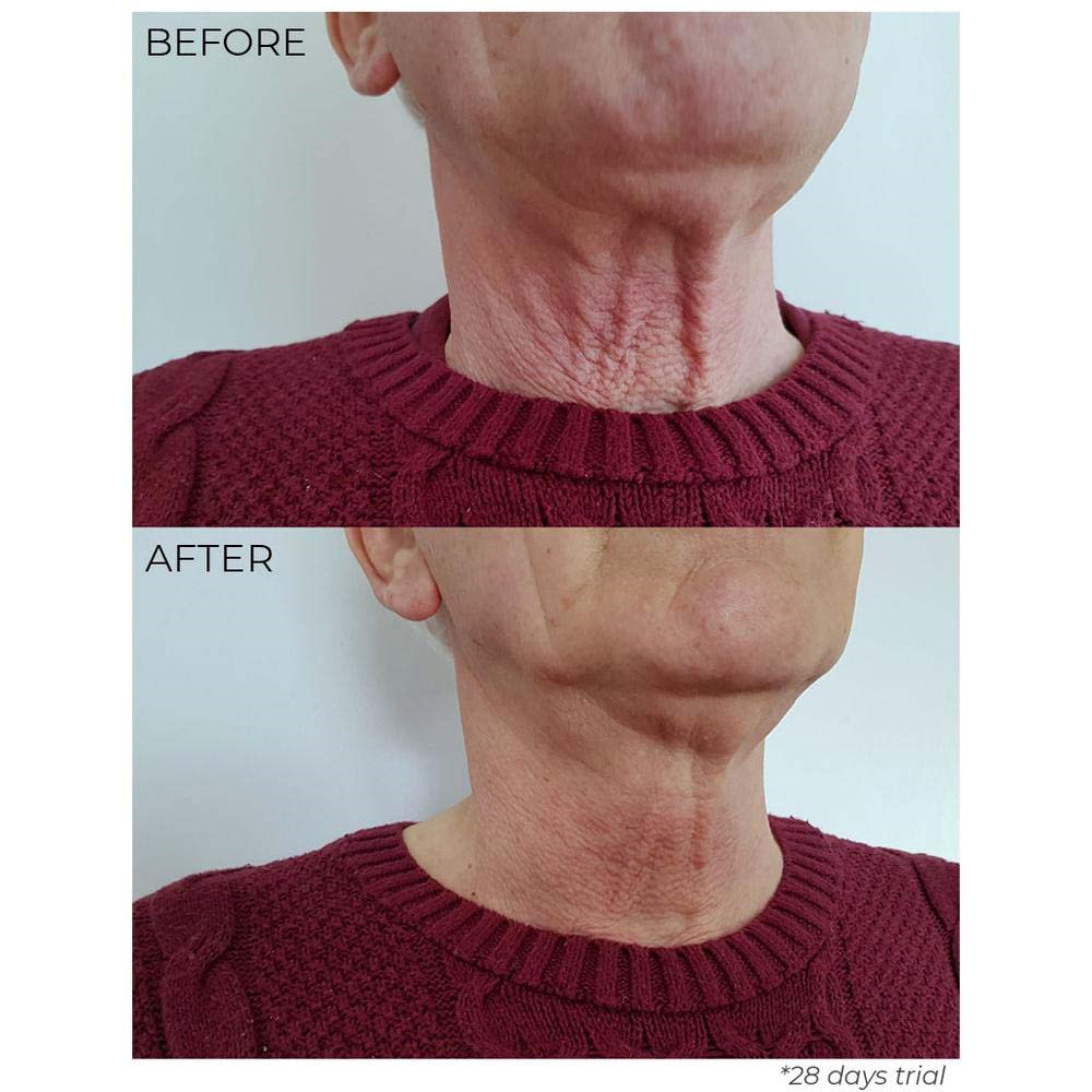 Nourish London TSL Tighten, Lift and Sculpt Neck Elixir 30 ml (obrázok 4)