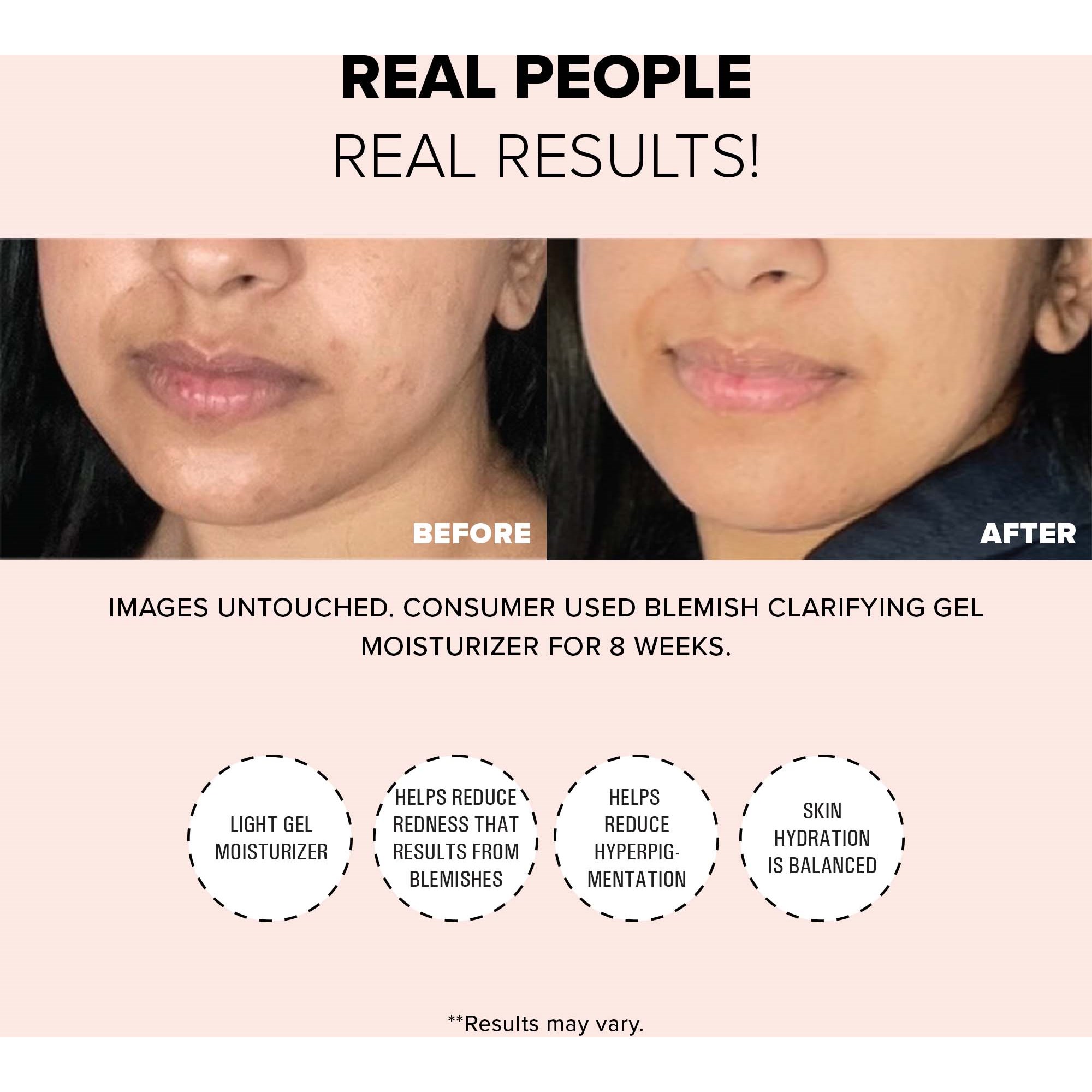 Nudestix Blemish Clarifying Gel Moisturizer 60 ml (obrázok 3)