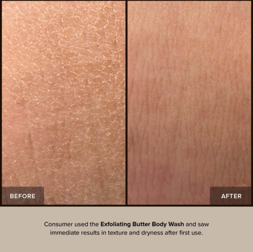 Jämförelse visar huden före och efter användning av Exfoliating Butter Body Wash, med slätare hud efter användning.