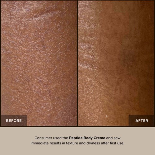 Huden ser glattere og mere hydratiseret ud efter brug af Peptide Body Creme.