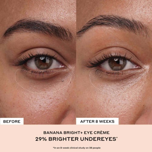 Sammenligning som viser mørke ringer under øynene før og etter 8 uker med Banana Bright+ Eye Crème. Huden ser lysere og klarere ut.