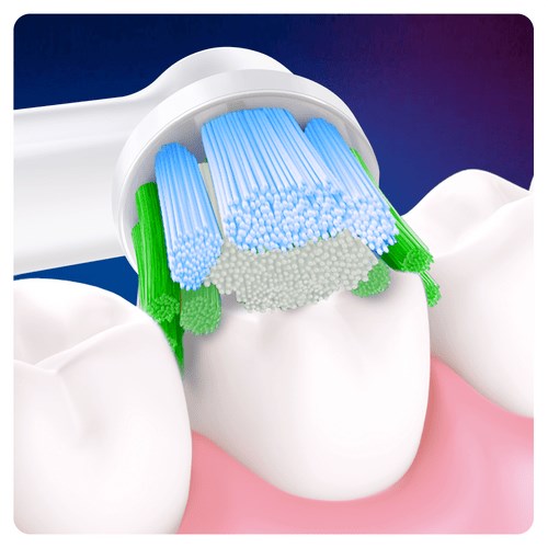 Przyrząd dentystyczny z niebieskimi, zielonymi i białymi włóknami czyszczący powierzchnię zęba.
