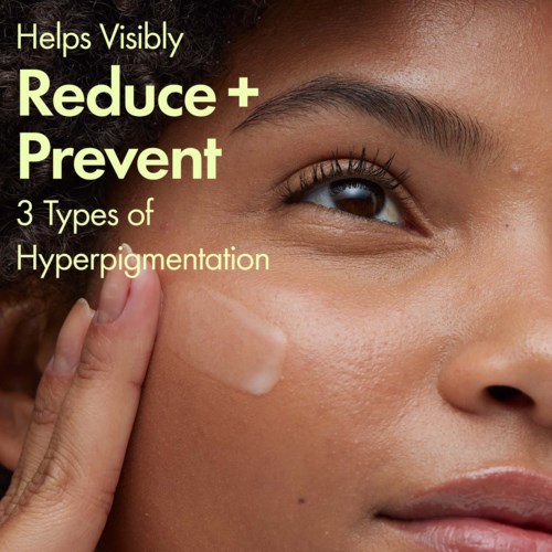A woman applies skincare cream near her eye, promoting reducing and preventing hyperpigmentation.