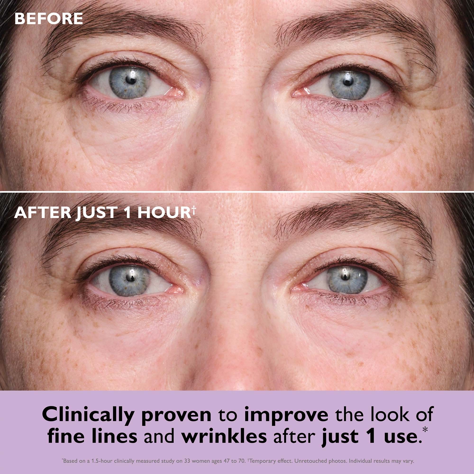 Peter Thomas Roth Instant FIRMx® Collagen Infusion Tightening Eye Patc (obrázok 5)