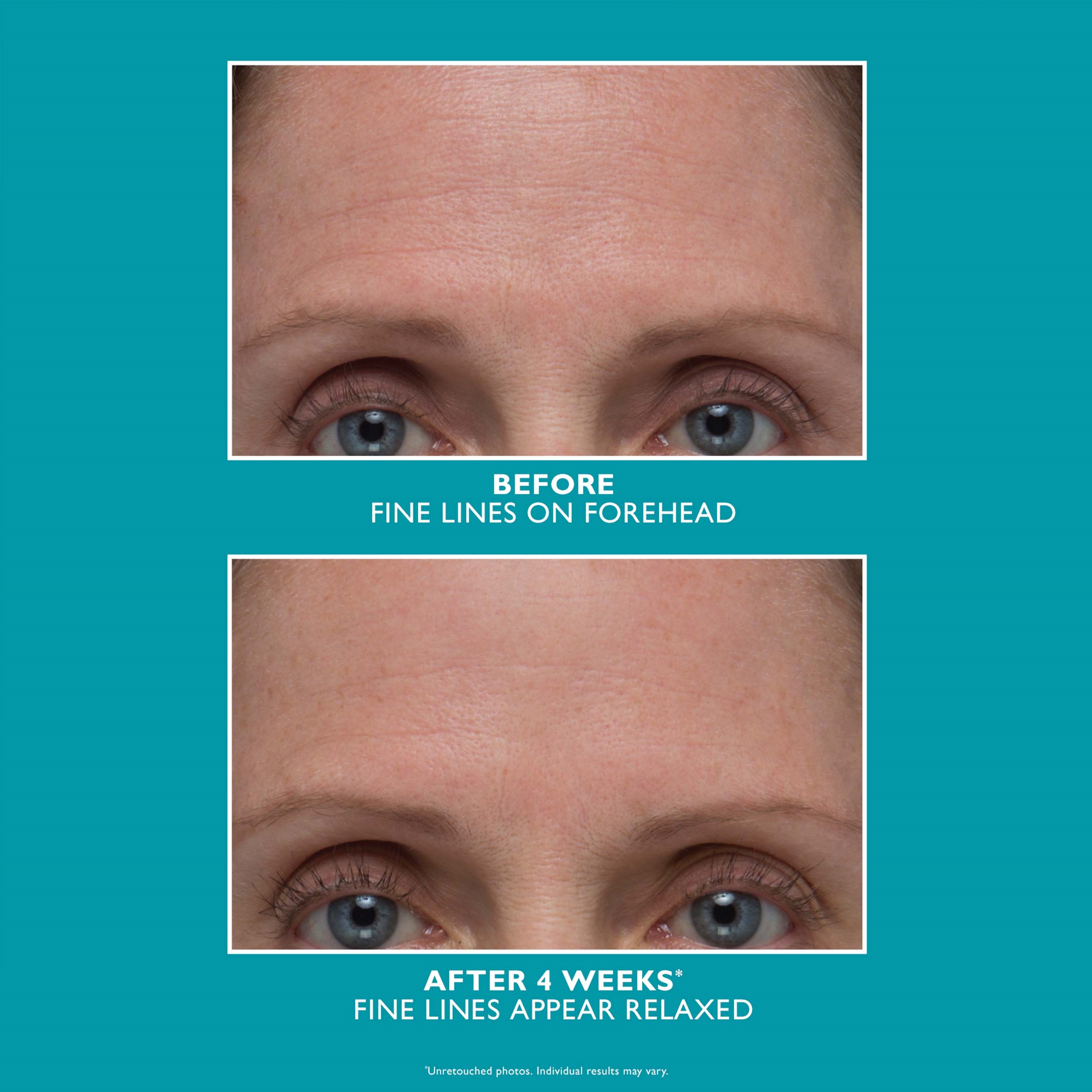 Peter Thomas Roth Peptide Skinjection Amplified Wrinkle-Fix Serum 30 m (obrázok 3)