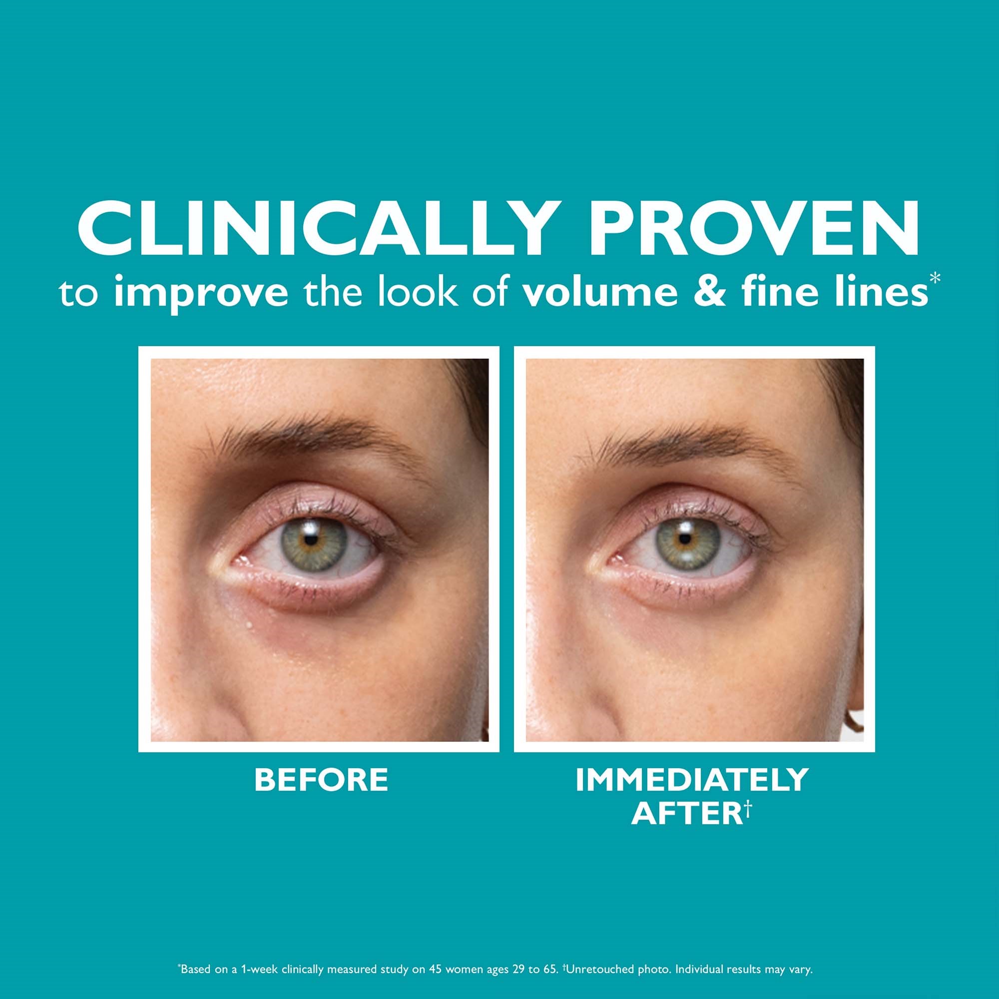 Peter Thomas Roth PTR Peptide Skinjection™ Fill + Fix Under-Eye Cream (zdjęcie 6)