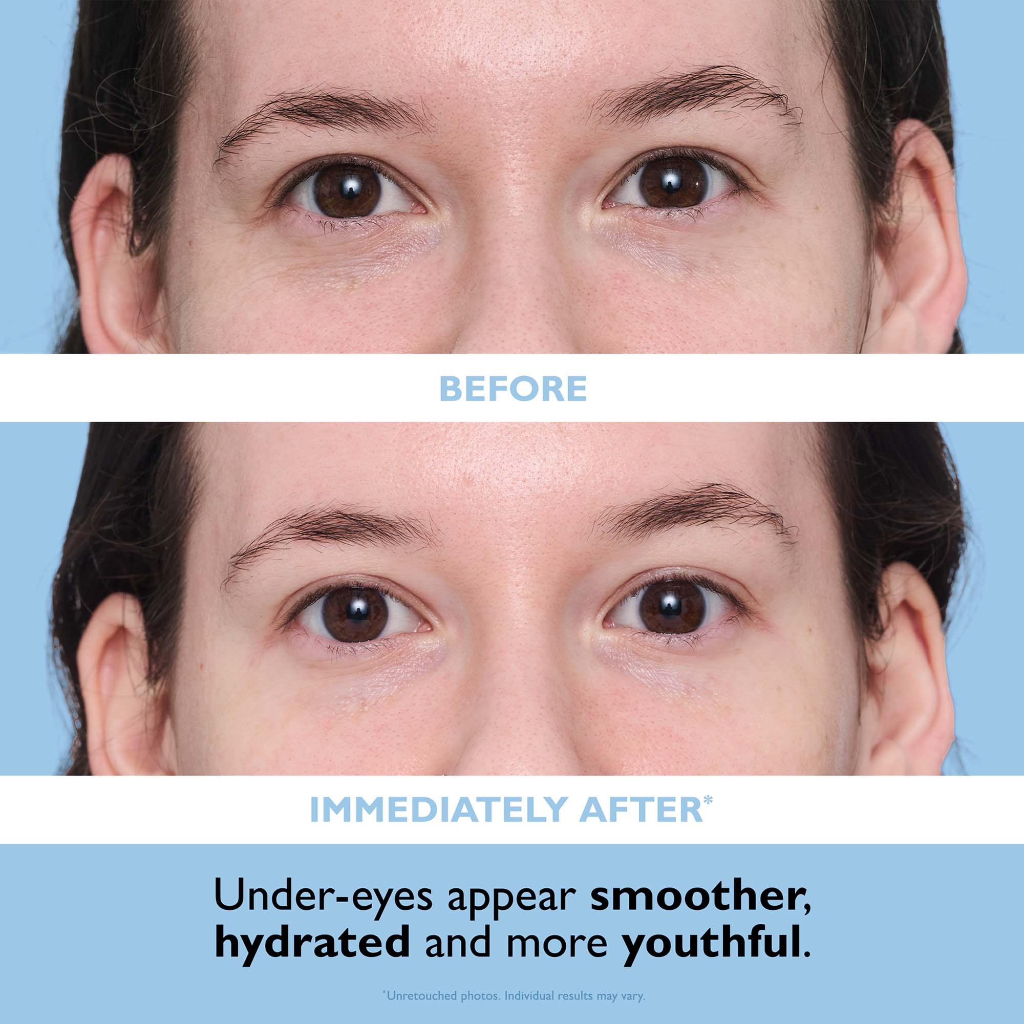 Peter Thomas Roth Hyaluronic Cloud Eye Patches (obrázok 4)