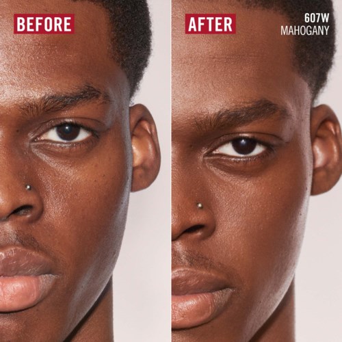 Vorher- und Nachher-Bilder der Hautverbesserung, zeigen klarere und glattere Haut im Nachher-Bild. Text oben zeigt "BEFORE" und "AFTER".