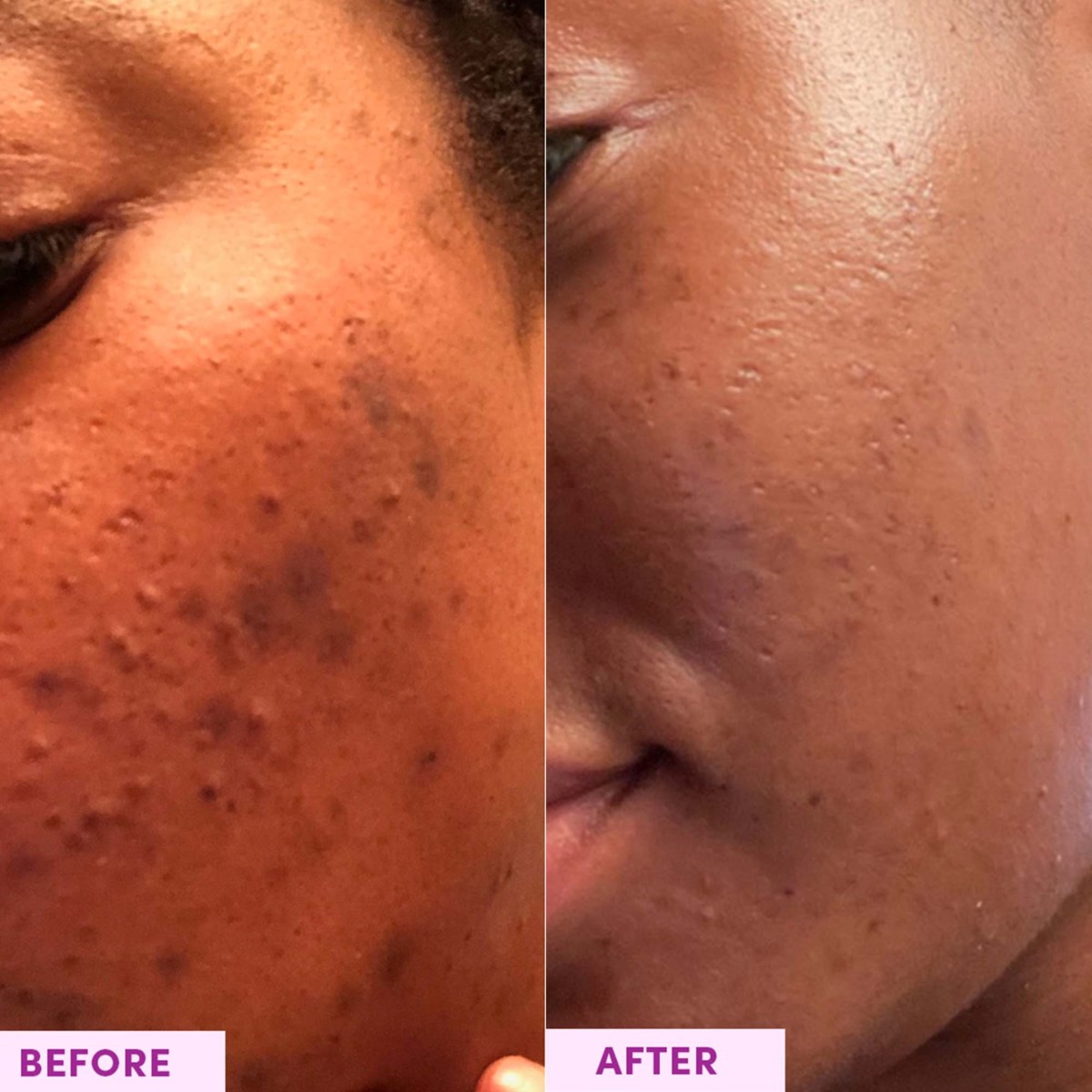 Энзимная пудра-эксфолиант для лица Sand & Sky Australian Glow Berries Enzyme Powder Exfoliator для сияния кожи, 60 г — фото 4
