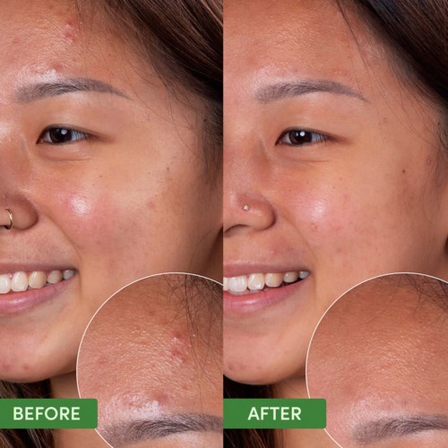 Очищающая маска для лица Sand & Sky Oil Control Clearing Face Mask себорегулирующая, для жирной и проблемной кожи, 100 г — фото 4