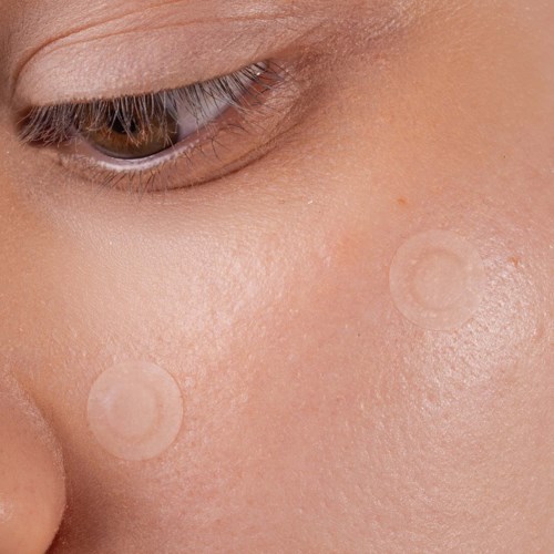 Close-up van een person's wang met twee doorzichtige pleisters op de huid.
