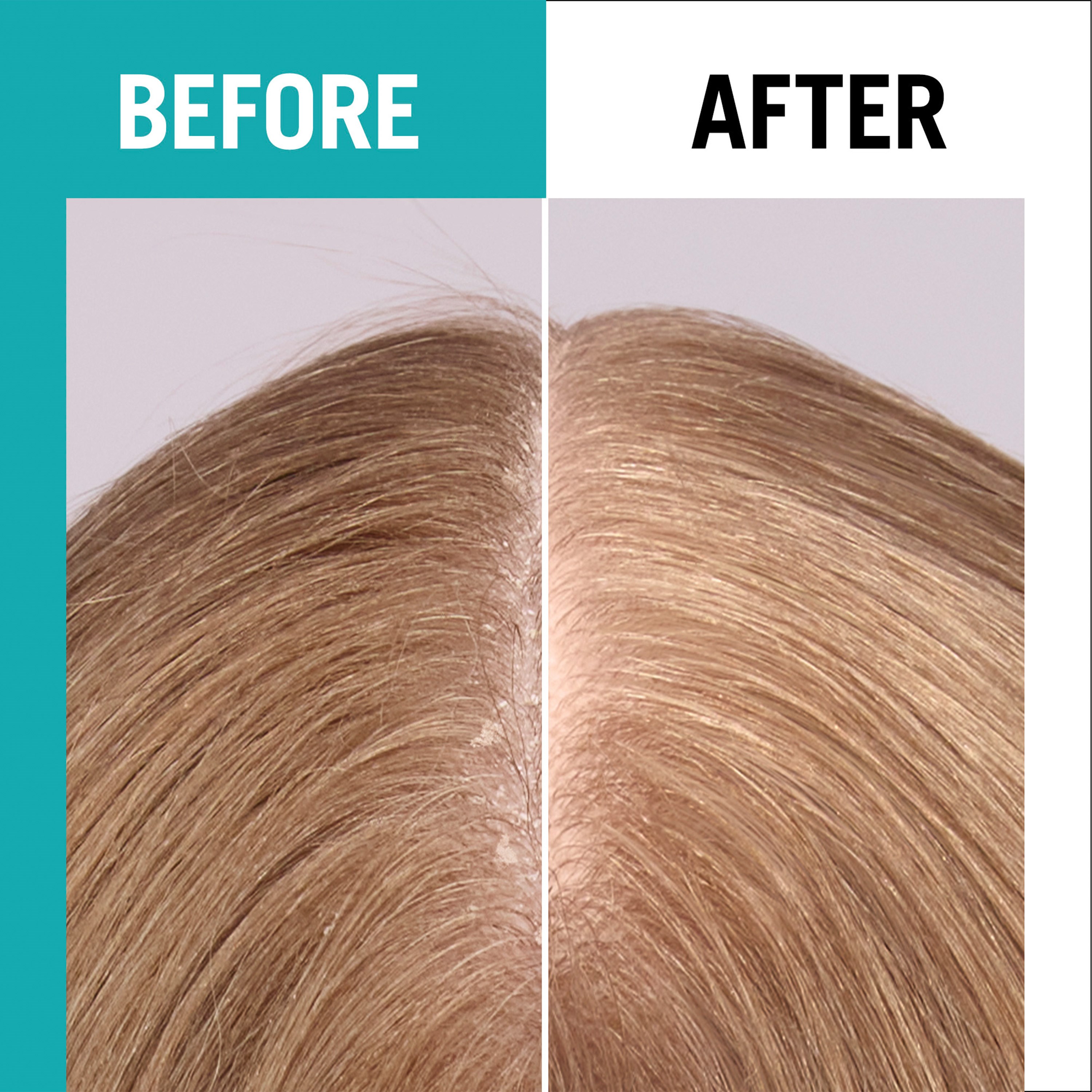 Schwarzkopf Gliss Scalp Balance Gentle Shampoo 200 ml (obrázok 5)