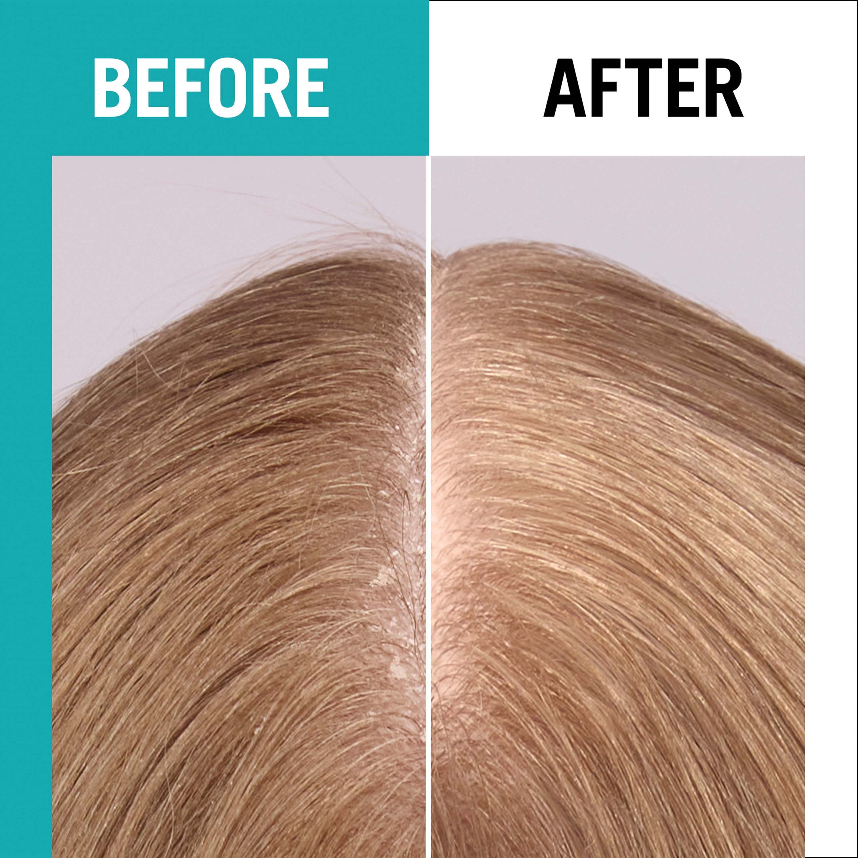 Schwarzkopf Gliss Scalp Balance Scalp Spray 100 ml (obrázok 5)