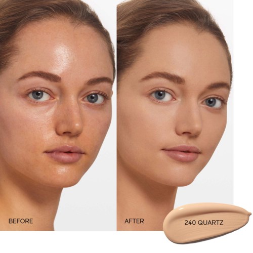 Before and after photos of a woman showing clear skin and smooth complexion. Text: "240 QUARTZ."