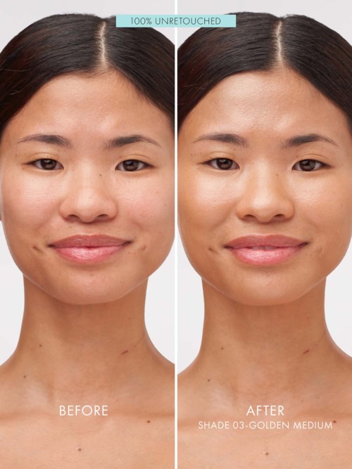 A woman shows clearer skin and a brighter smile before and after using a skin product.