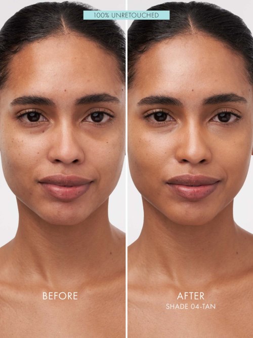 A woman's face showing before and after skincare results, with clear and smooth skin after treatment.