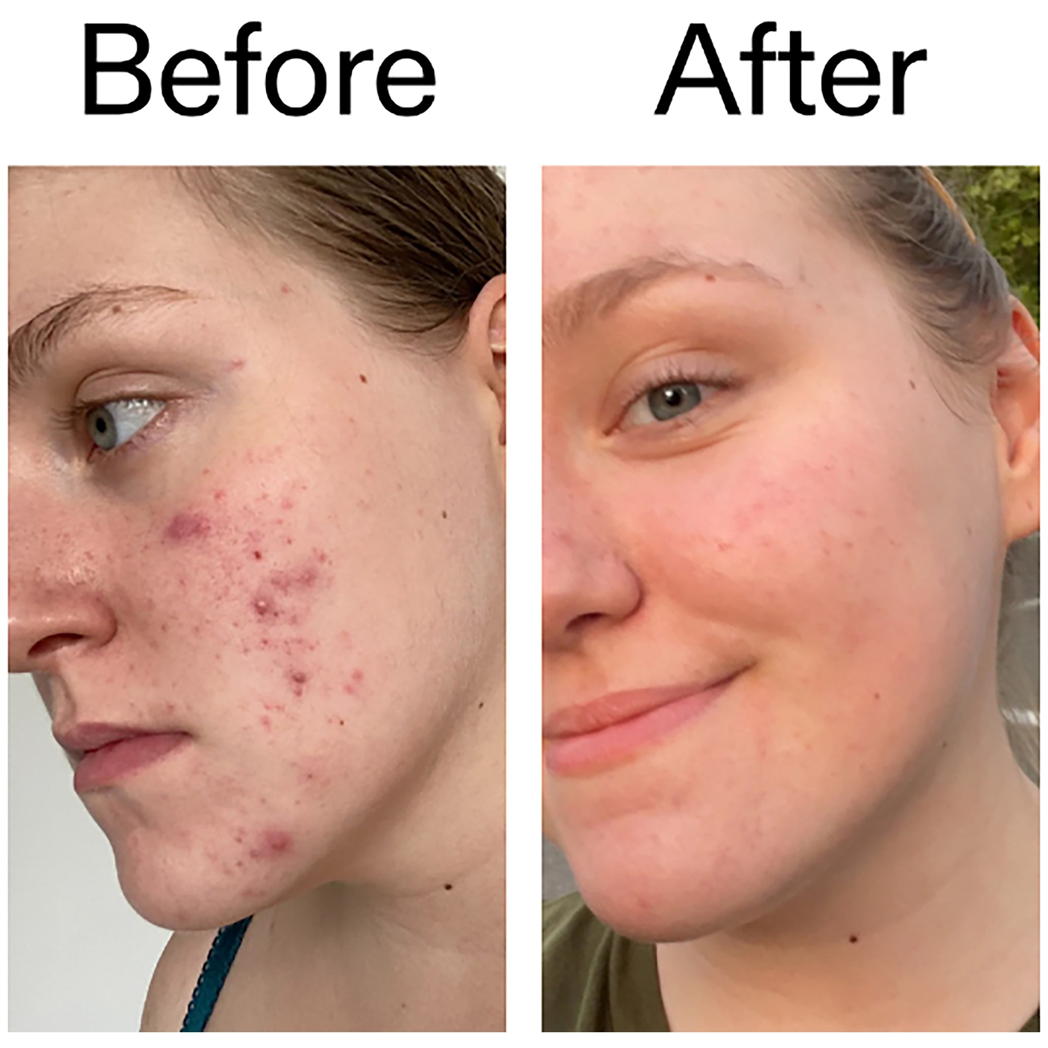 The Inkey List Vitamin C and EGF Serum 30 ml (obrázok 4)