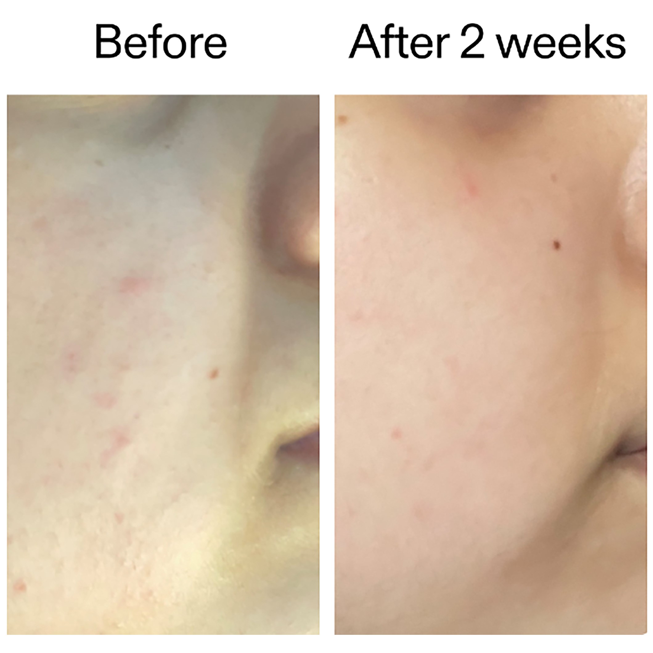 The Inkey List 360 Skin Clearing Serum 30 ml (obrázok 4)