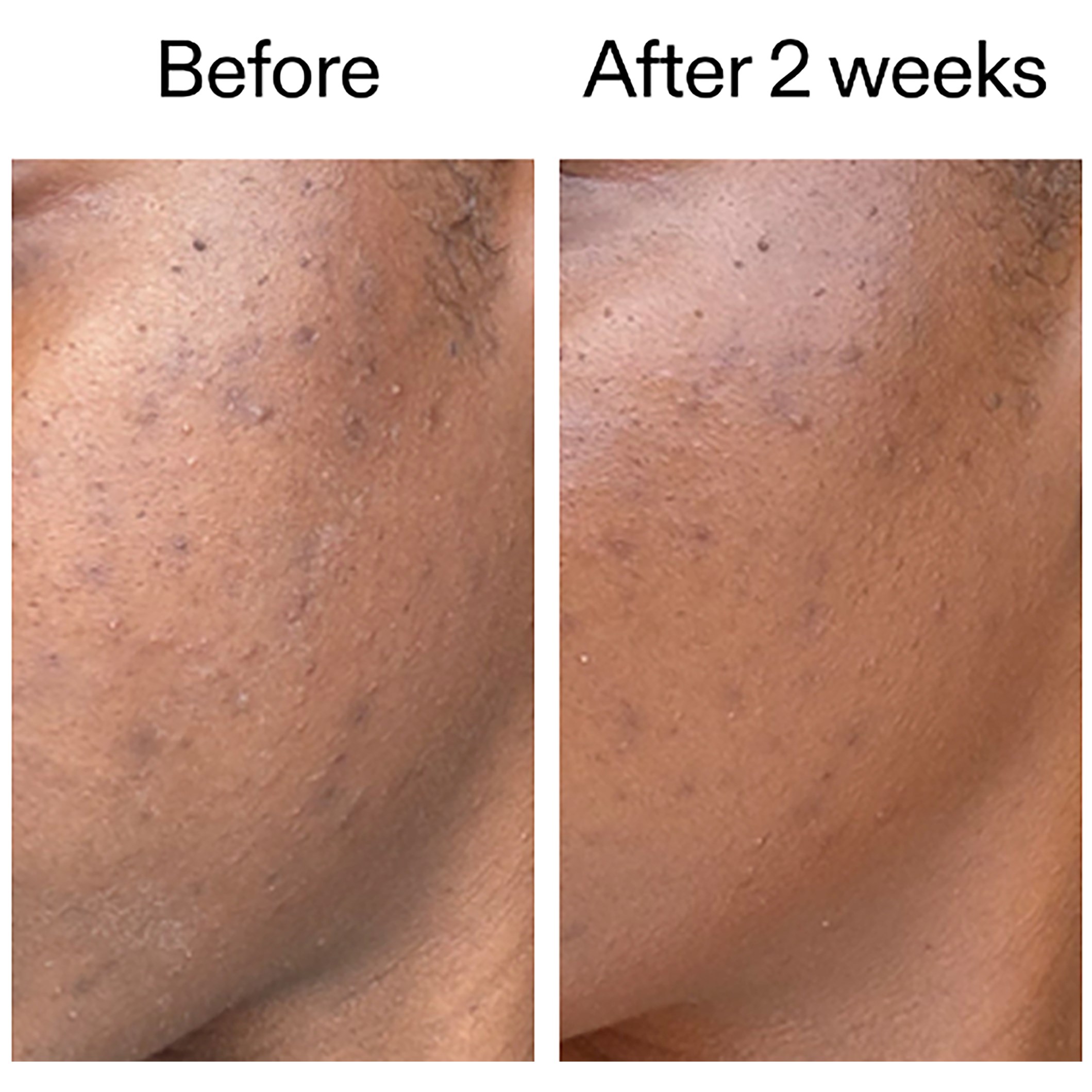 The Inkey List 360 Skin Clearing Serum 30 ml (obrázok 5)