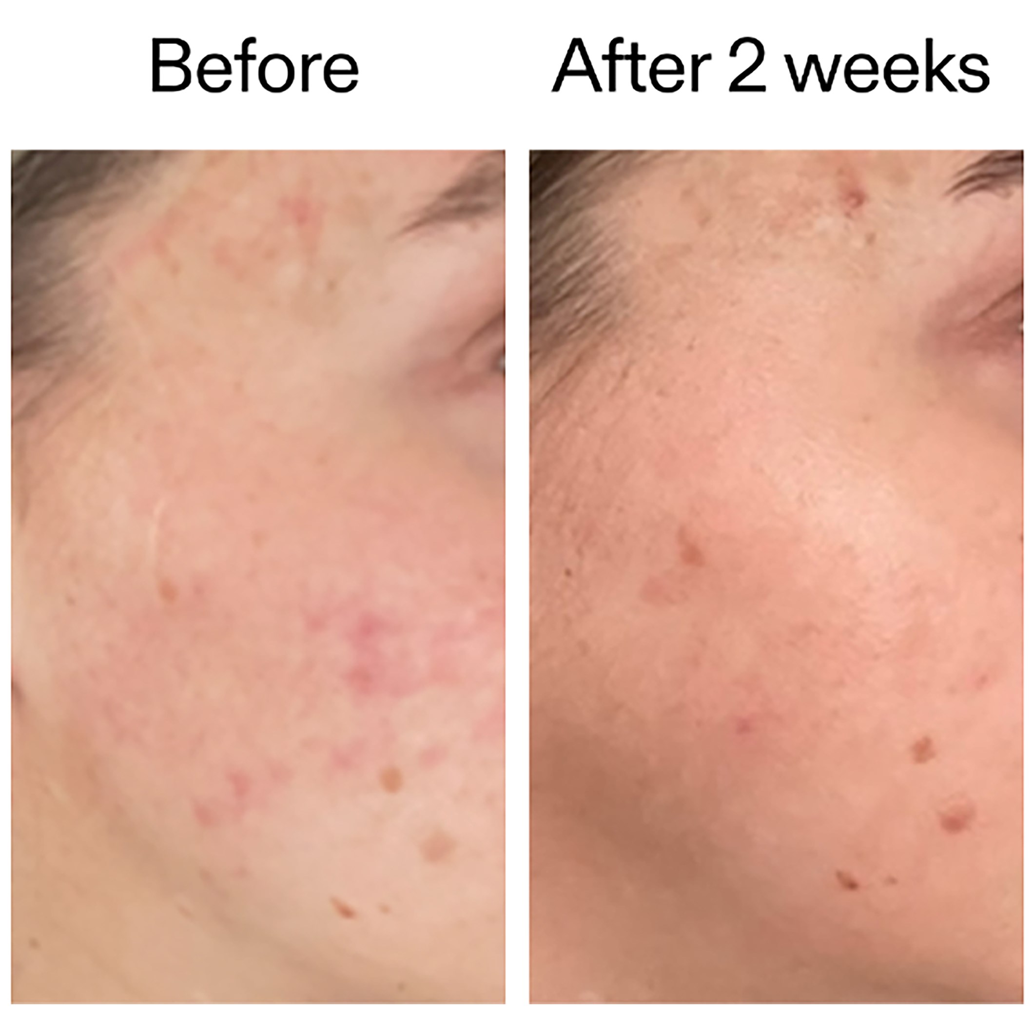 The Inkey List 360 Skin Clearing Serum 30 ml (obrázok 6)