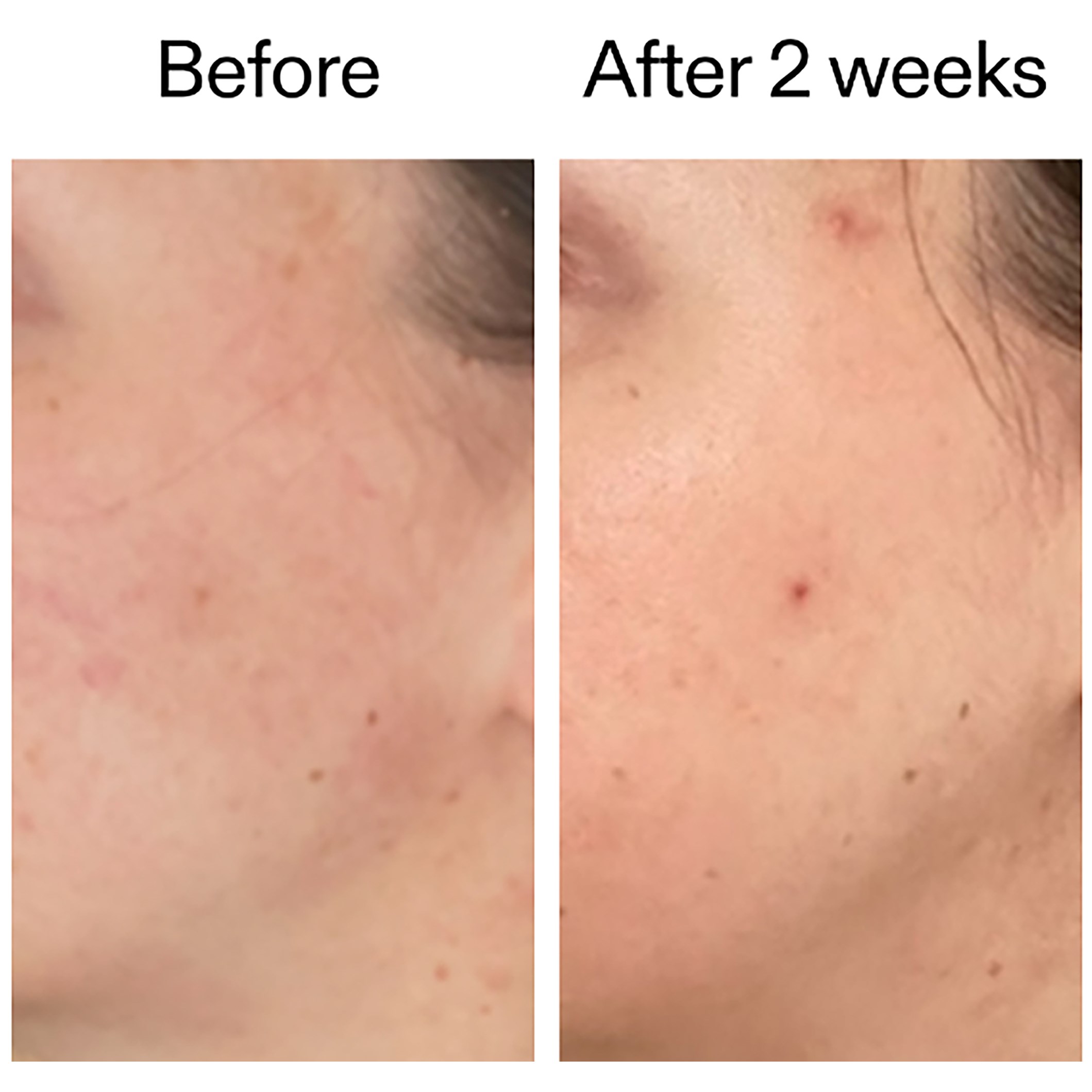 The Inkey List 360 Skin Clearing Serum 30 ml (obrázok 7)
