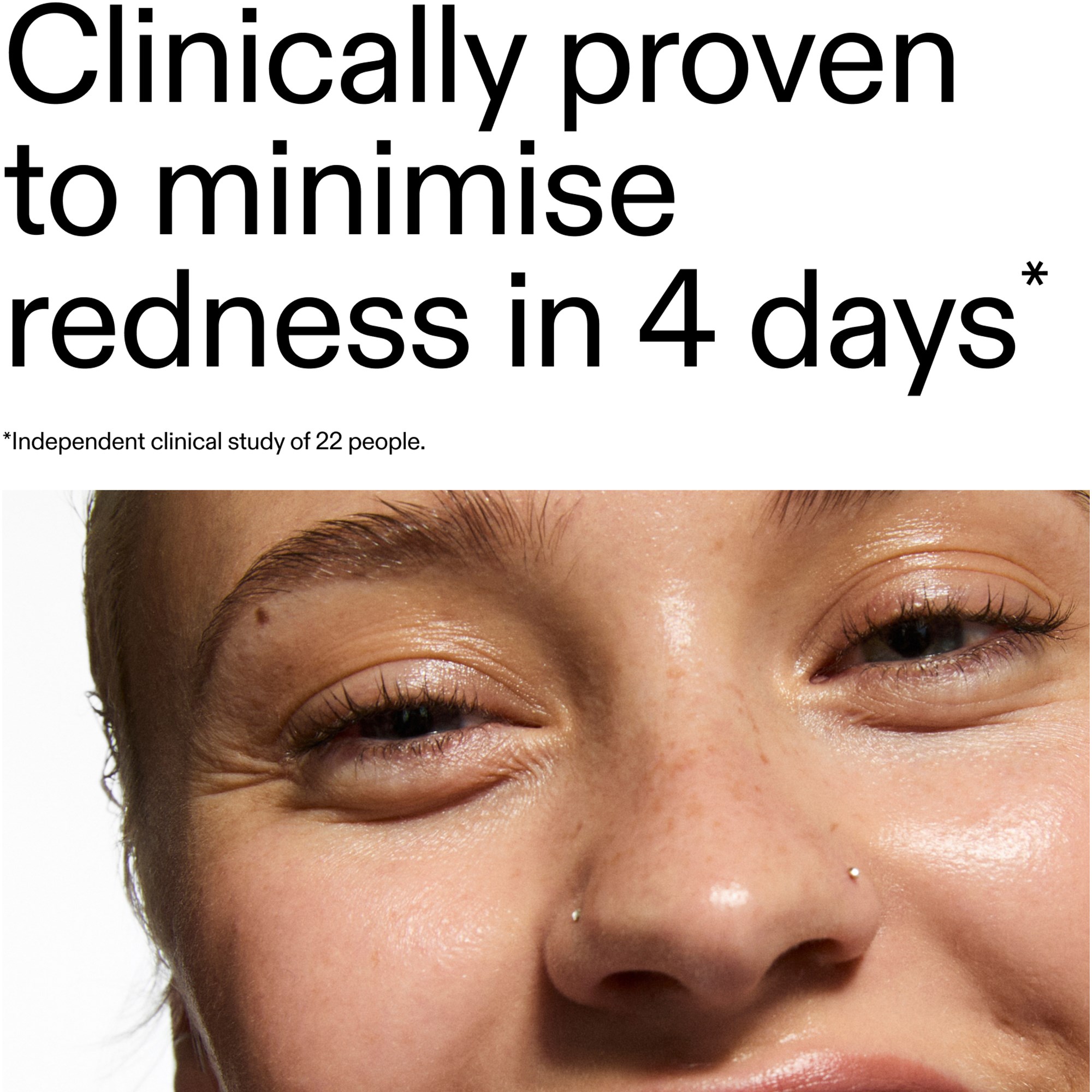 The Inkey List Azelaic Acid 10% Serum 30 ml (obrázok 8)