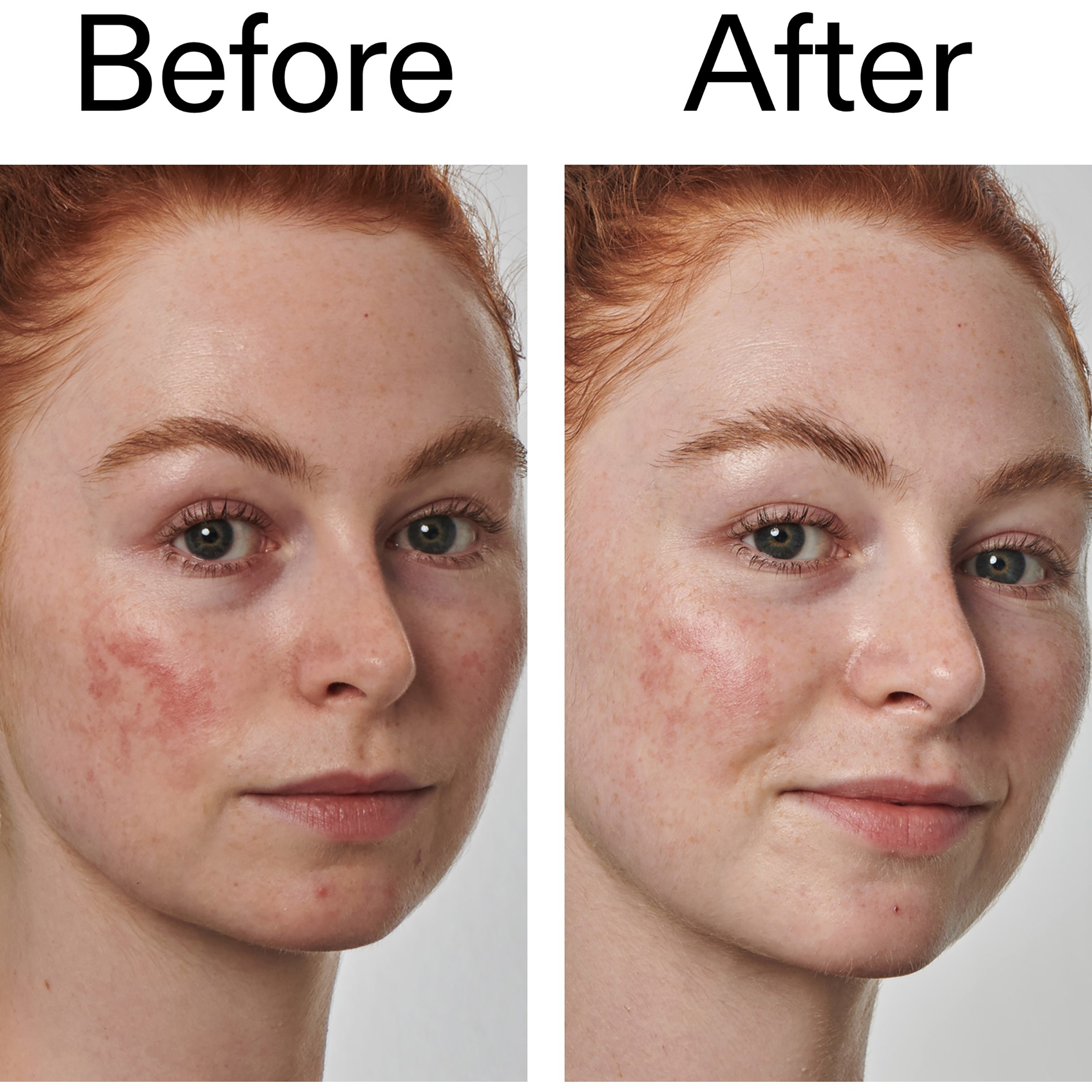 The Inkey List Azelaic Acid 10% Serum 30 ml (obrázok 9)