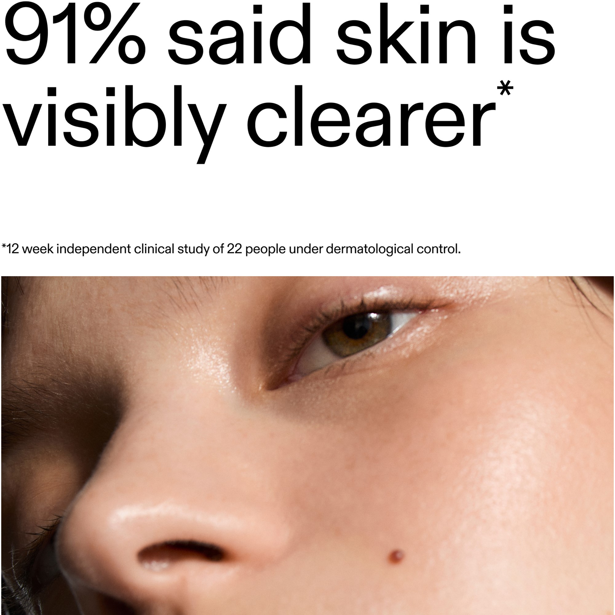 The Inkey List Blemish Clearing Moisturizer 2% Novoretin 50 ml (obrázok 8)