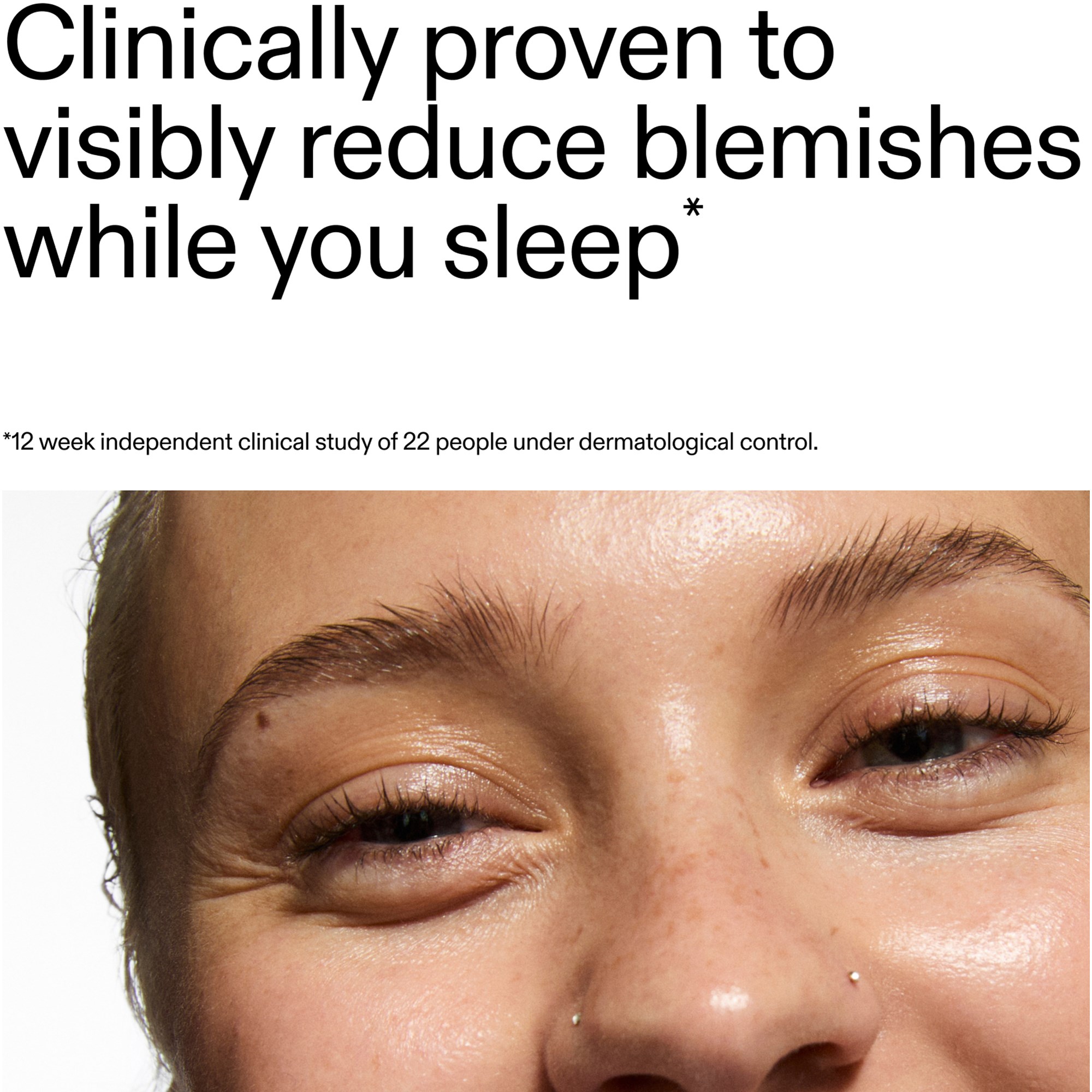 The Inkey List Blemish Clearing Moisturizer 2% Novoretin 50 ml (obrázok 9)