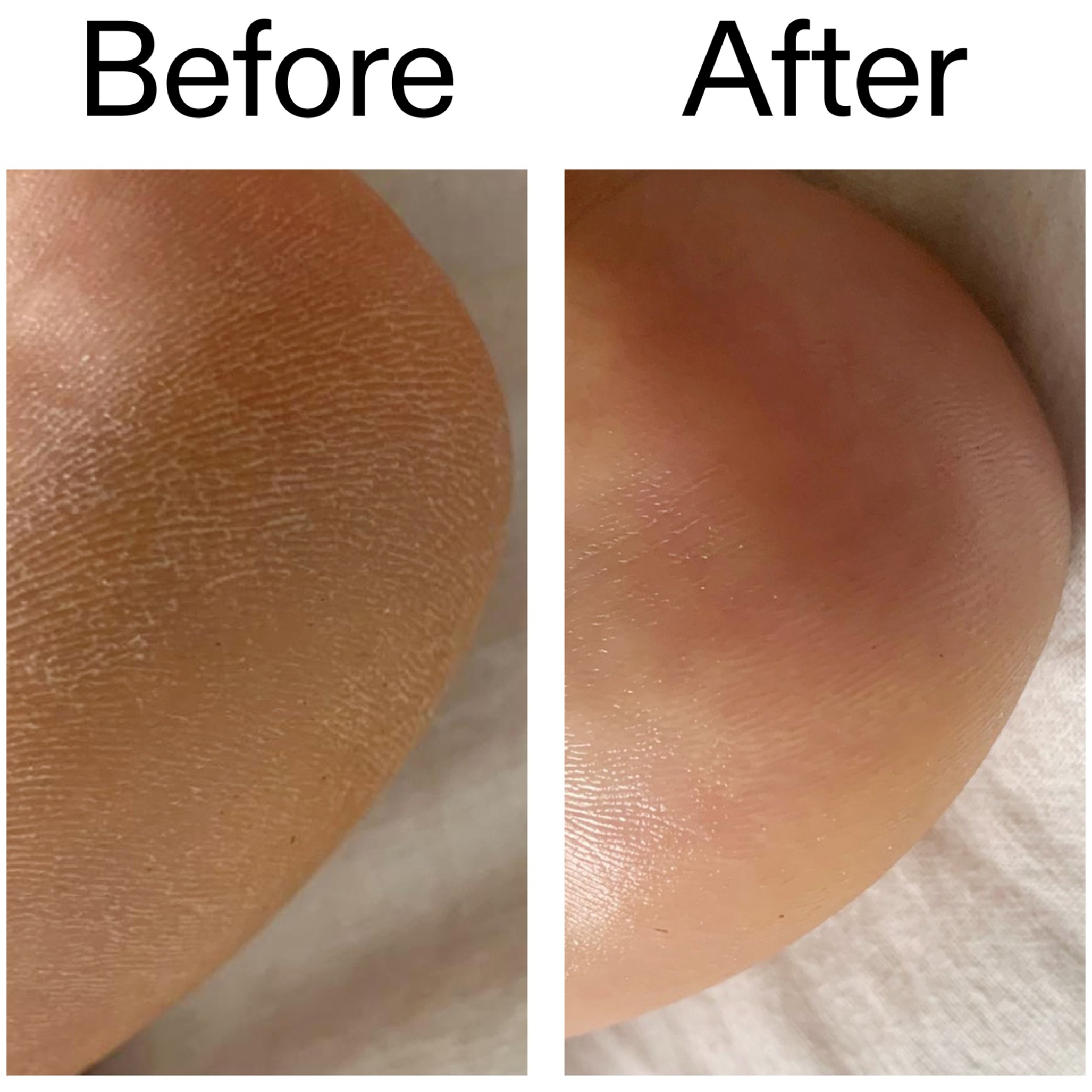 The Inkey List Glycolic Acid Exfoliating Body Stick 45 g (obrázok 10)