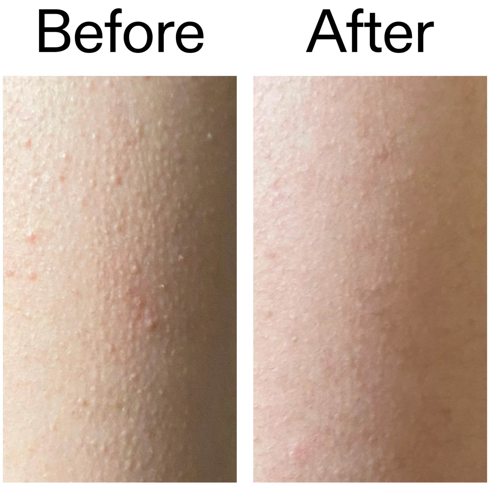 The Inkey List Glycolic Acid Exfoliating Body Stick 45 g (obrázok 11)