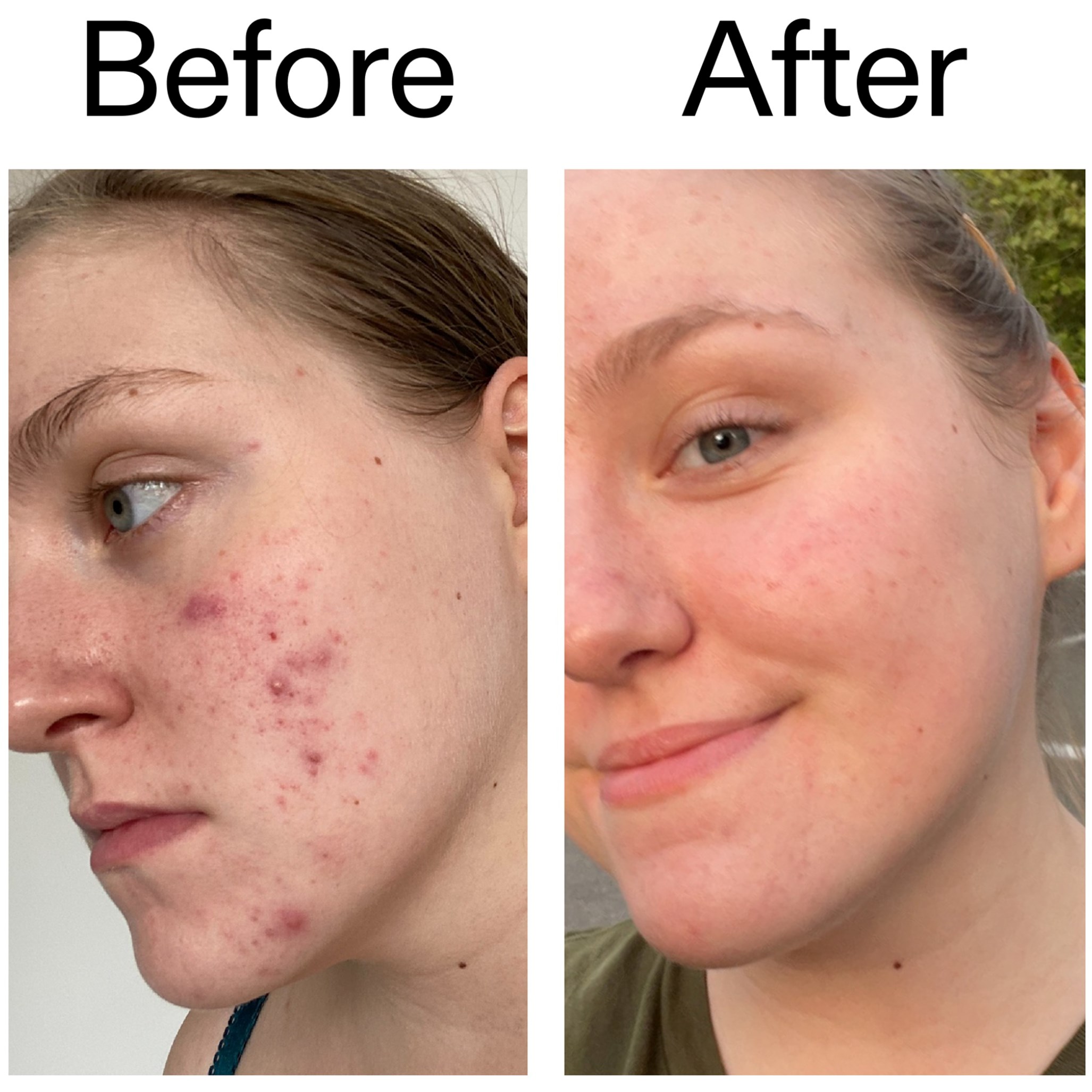 The Inkey List Glycolic Acid Toner 100 ml (obrázok 8)