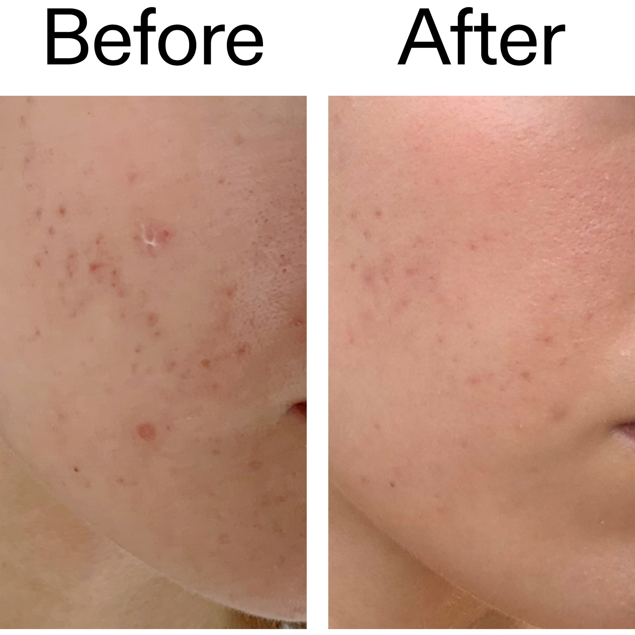 The Inkey List Mandelic Acid Treatment 15 ml (obrázok 10)