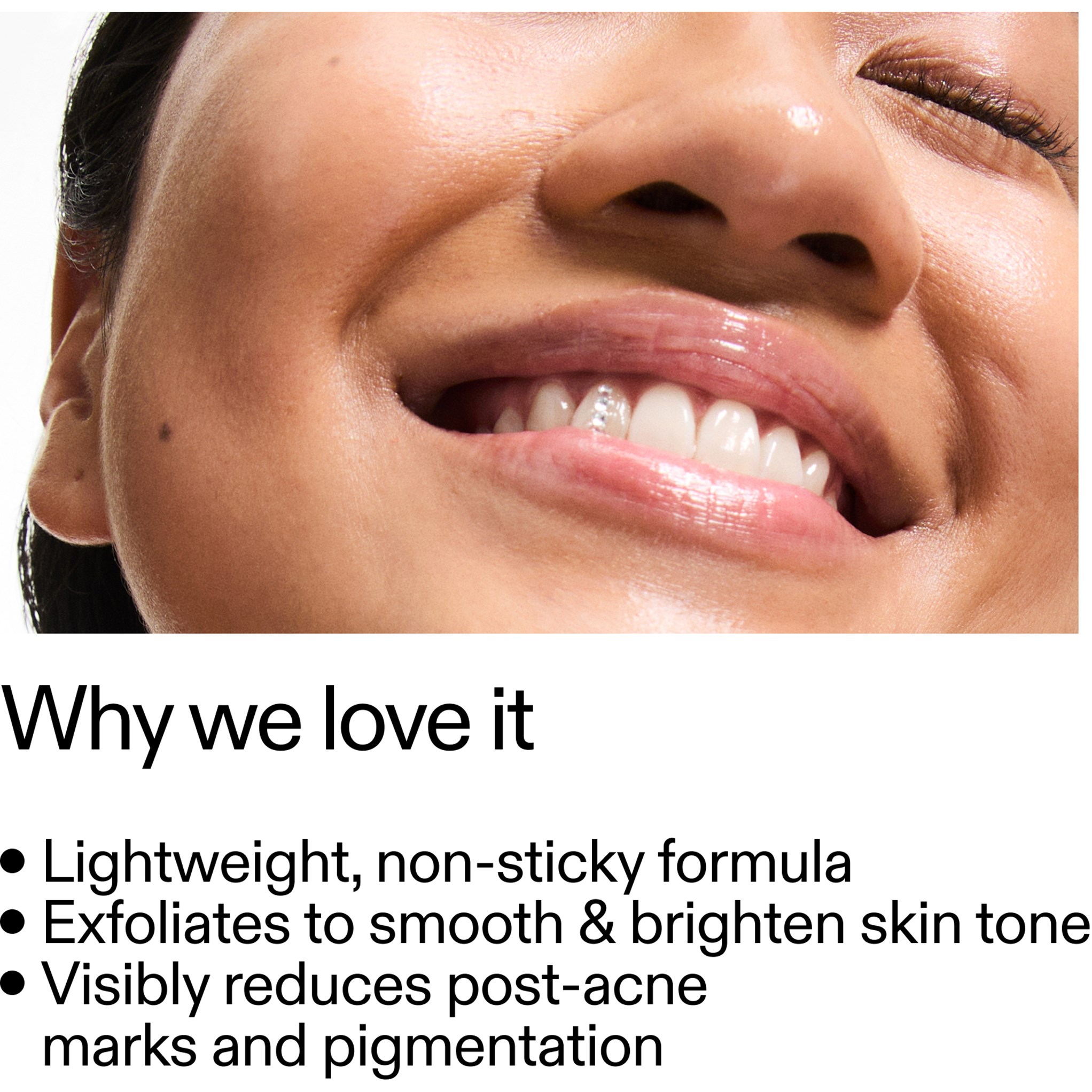 The Inkey List Mandelic Acid Treatment 15 ml (obrázok 7)
