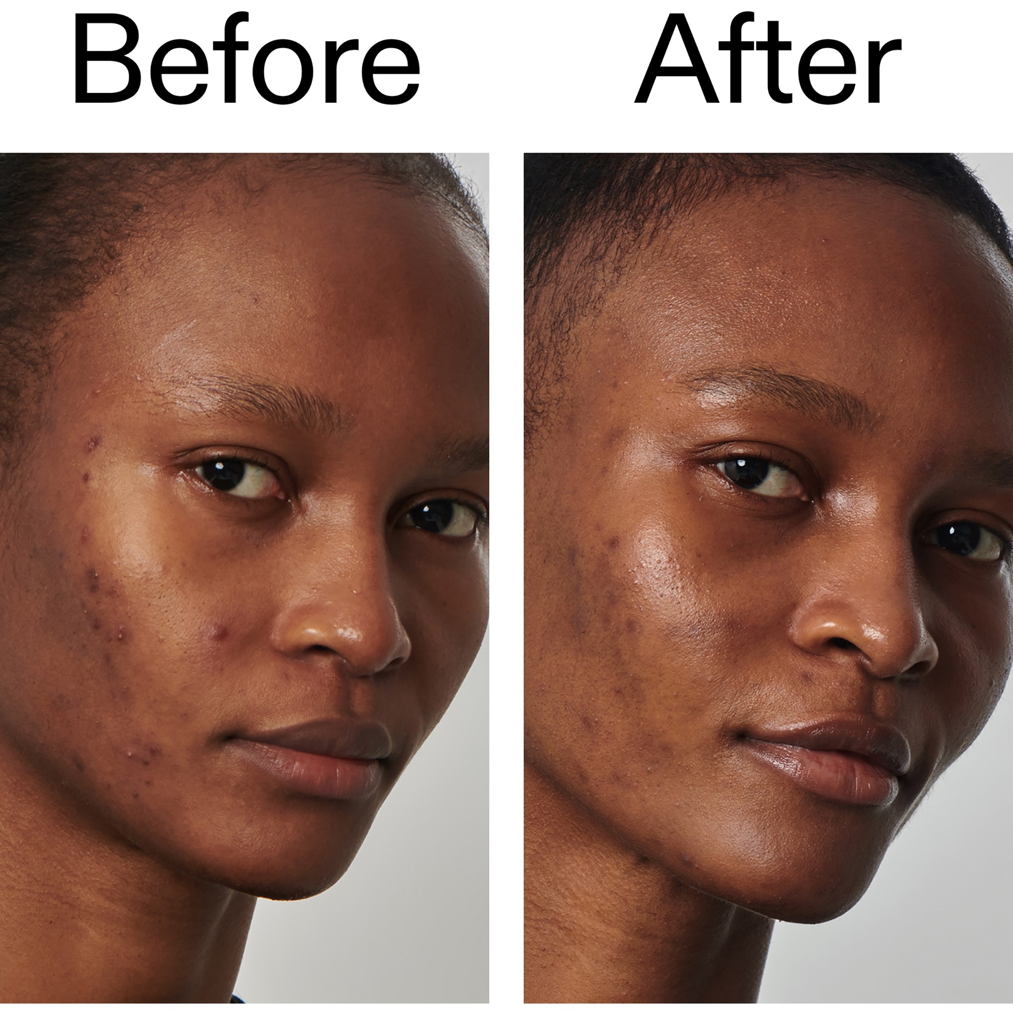 The Inkey List Niacinamide Serum 30 ml (obrázok 10)