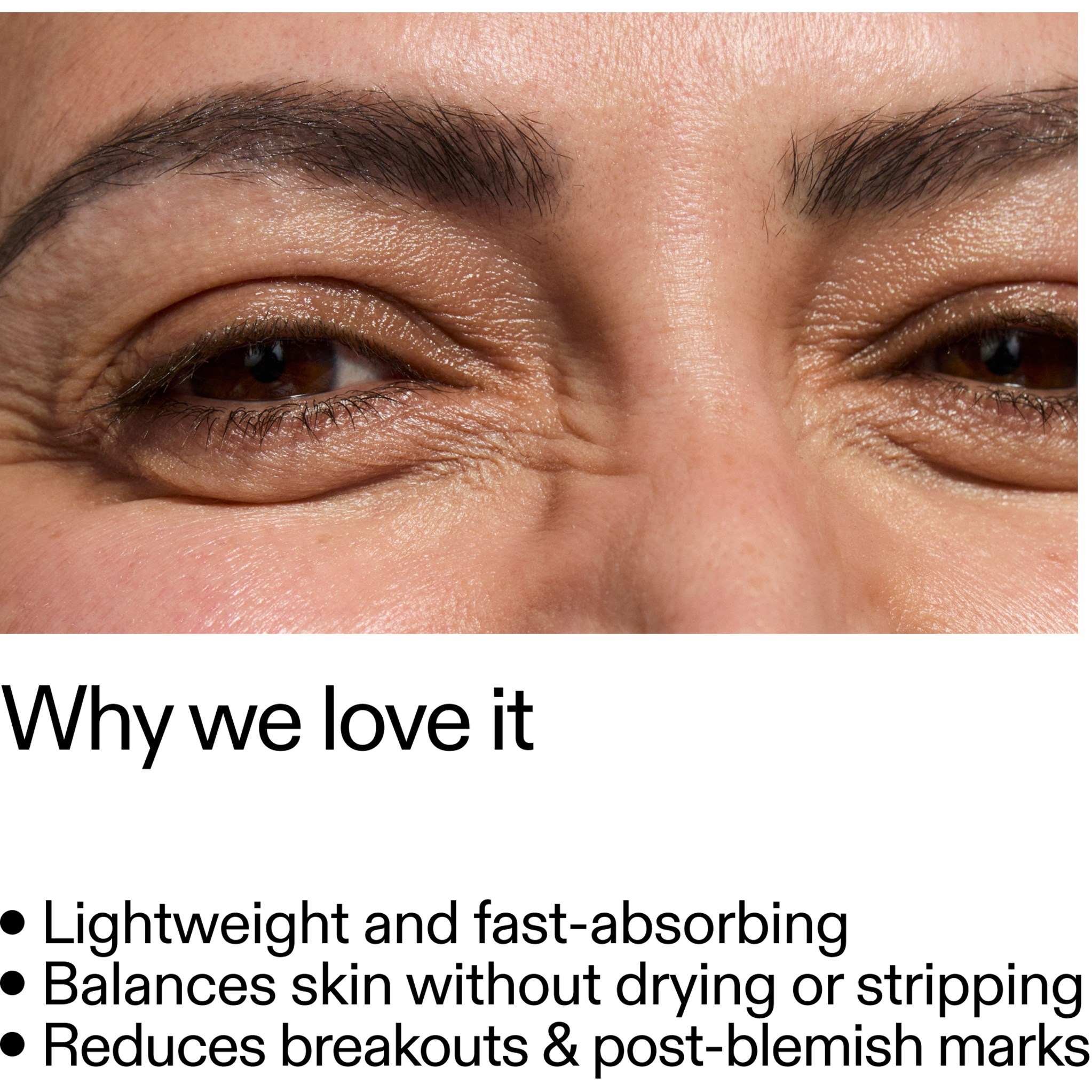 The Inkey List Niacinamide Serum 30 ml (obrázok 7)